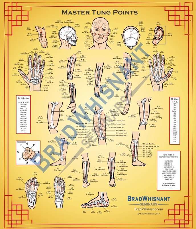 Master Tung Acupuncture Chart